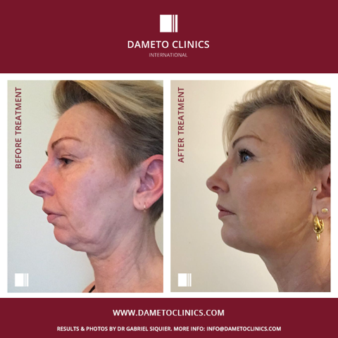 Dameto Clinics International