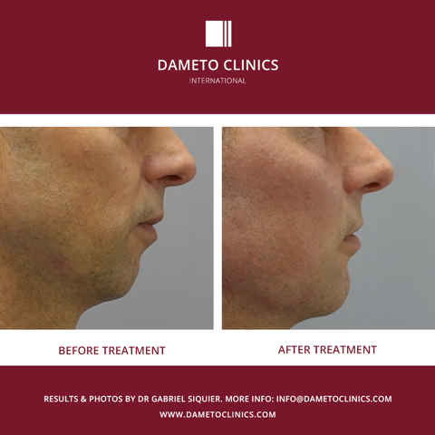 Dameto Clinics International